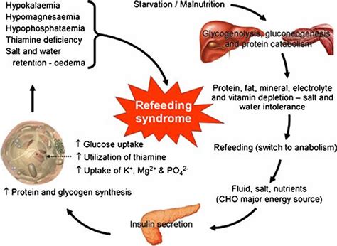 Refeeding syndrome: Causes, treatment, and .